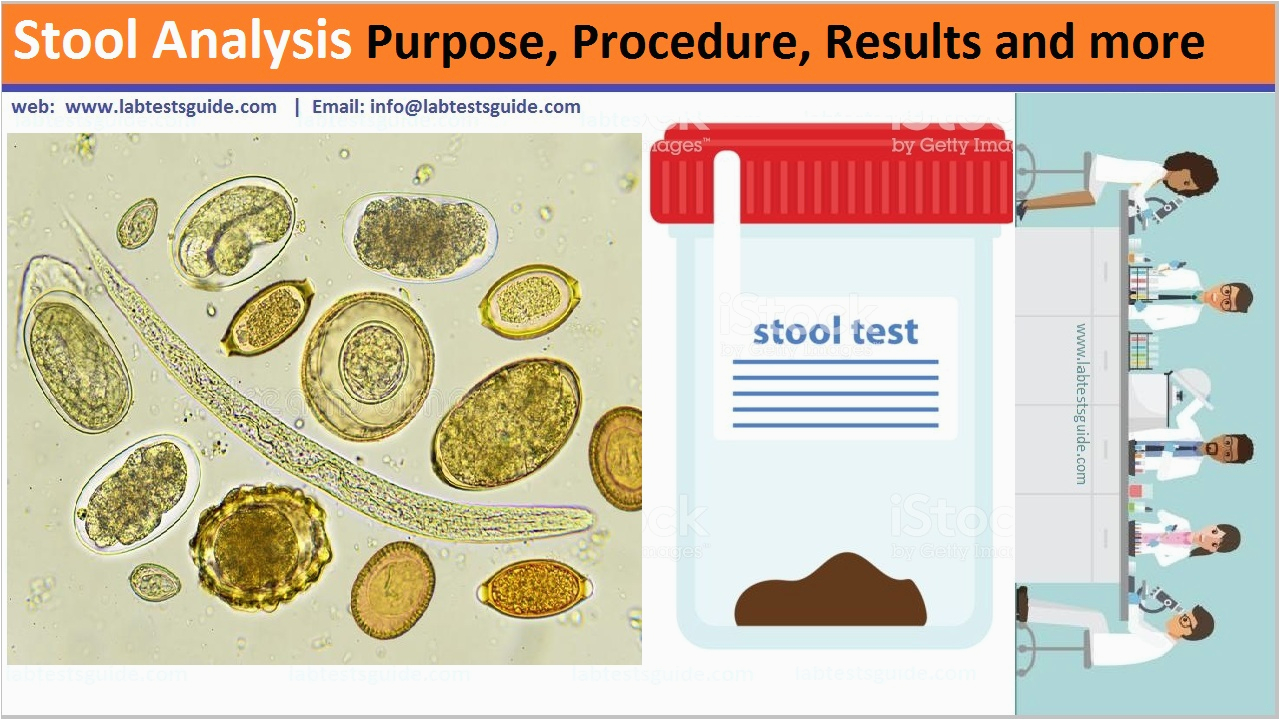 Processed Stool Samples In Lab Resume Stool Analysis Purpose Procedure Results and More Lab Tests Guide